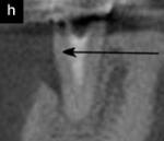 Figure 4h