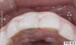 Fig. 6_2