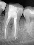 Long_term